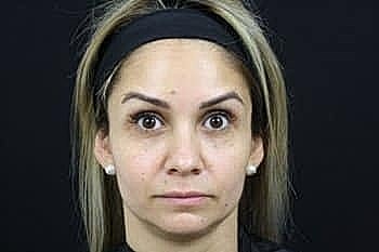 Female with light hair and neutral expression