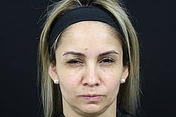 Person with straight blonde hair and serious expression.