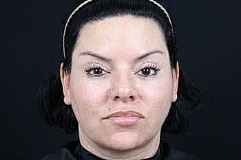 Woman with a neutral expression against a dark background.