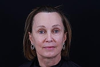 Portrait of a woman with short hair.