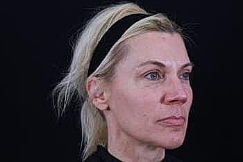 Woman with blonde hair, natural makeup, profile view.