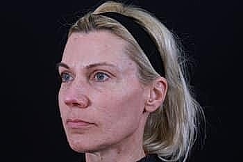 Woman with neutral expression and light hair.