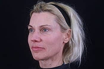 Woman with blonde hair against a dark background.