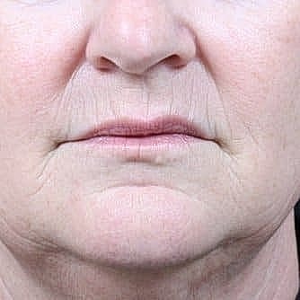 Close-up of an older woman's facial features.