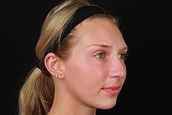 Profile view of a young woman with ponytail.