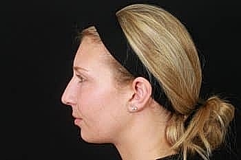 Profile view of a woman with blonde hair.