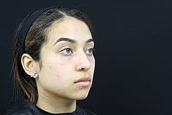 Young woman with natural makeup against dark background.