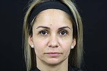 Woman with light blonde hair, neutral expression.