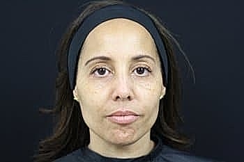 Woman with neutral expression against dark background.