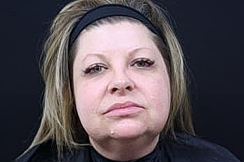 Woman with makeup-free face against dark background.