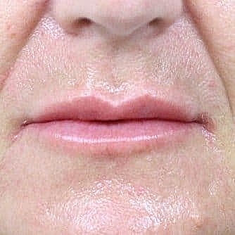 Close-up of human lips and chin.