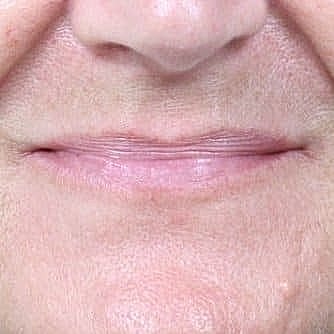 Close-up of a person's mouth.