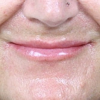 Close-up of a person's lips and chin.