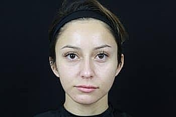 Person with clean skin against black background.