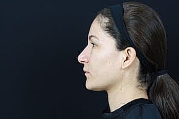 Profile of a woman against a dark background.