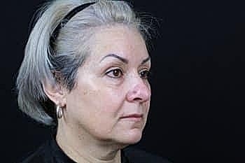 Profile of a mature woman with silver hair.