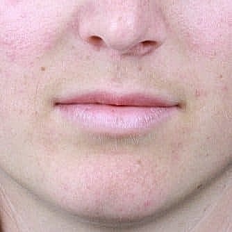 Close-up of a woman's mouth and chin.