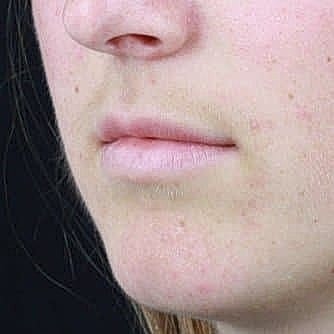 Close-up of a person's lips and chin.