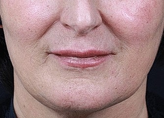 Close-up of a woman's lower face.