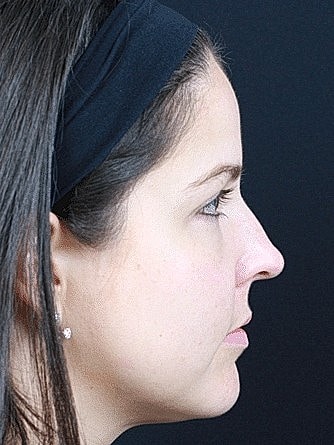 Profile of a woman with a headband.