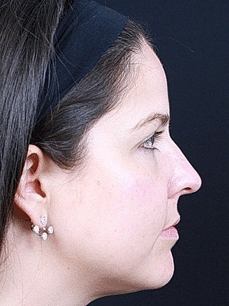 Profile view of a woman with earrings.