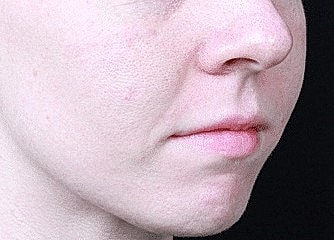 Profile view of a person's face.