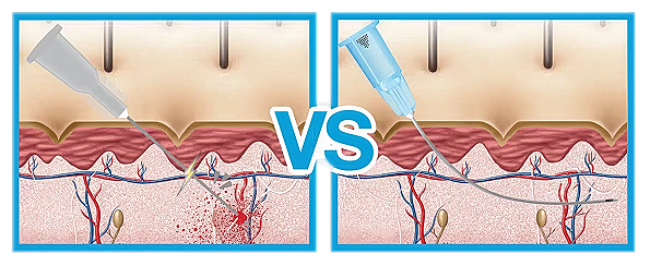 Comparison of two skin treatment methods.