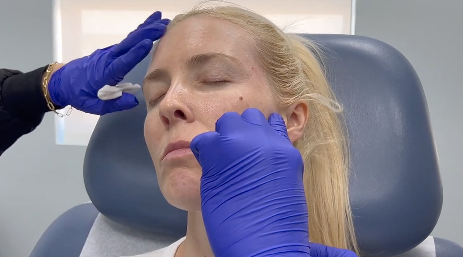 Patient receiving facial treatment in clinic setting.
