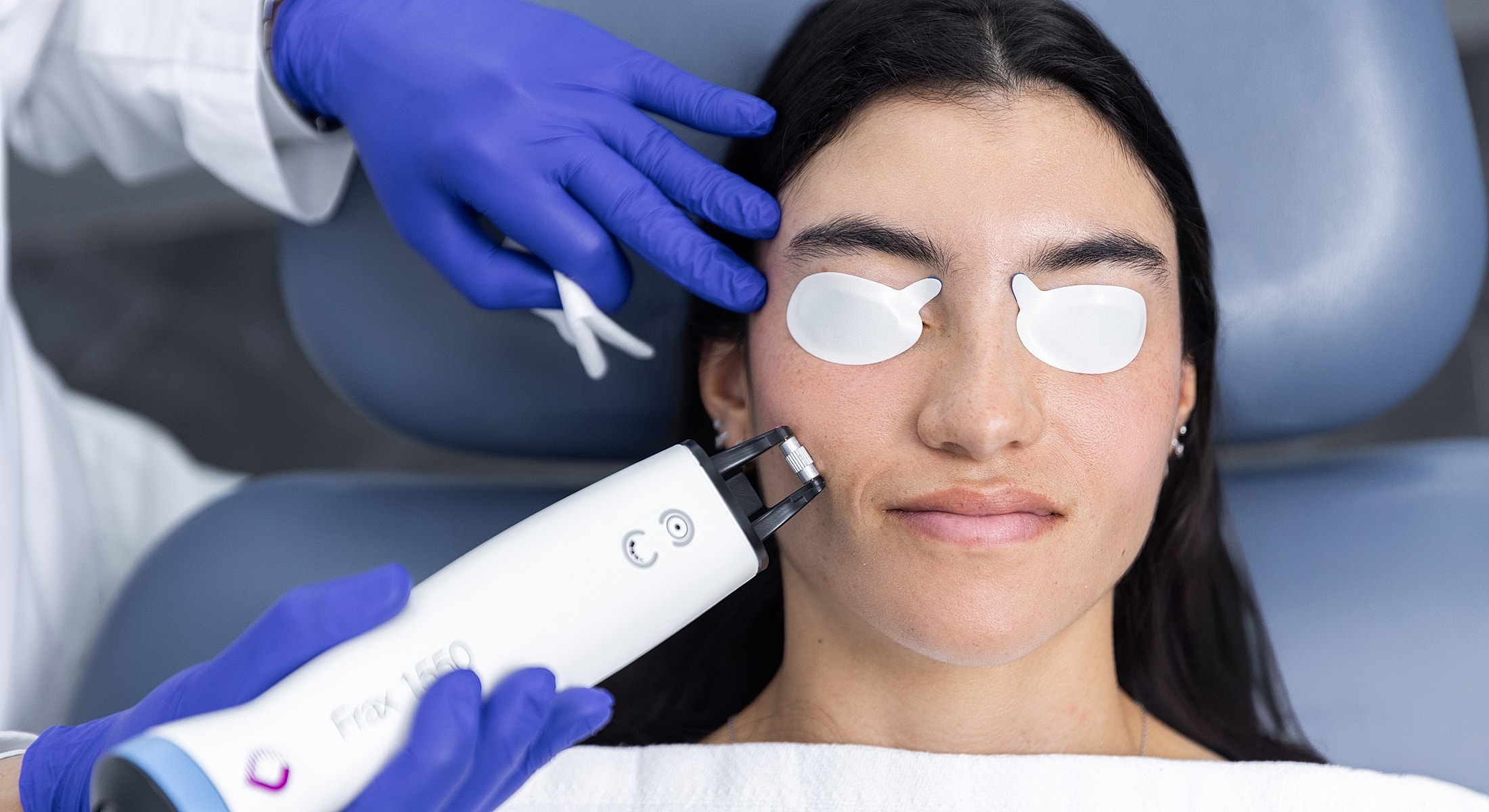 Facial treatment using a Frax laser device.